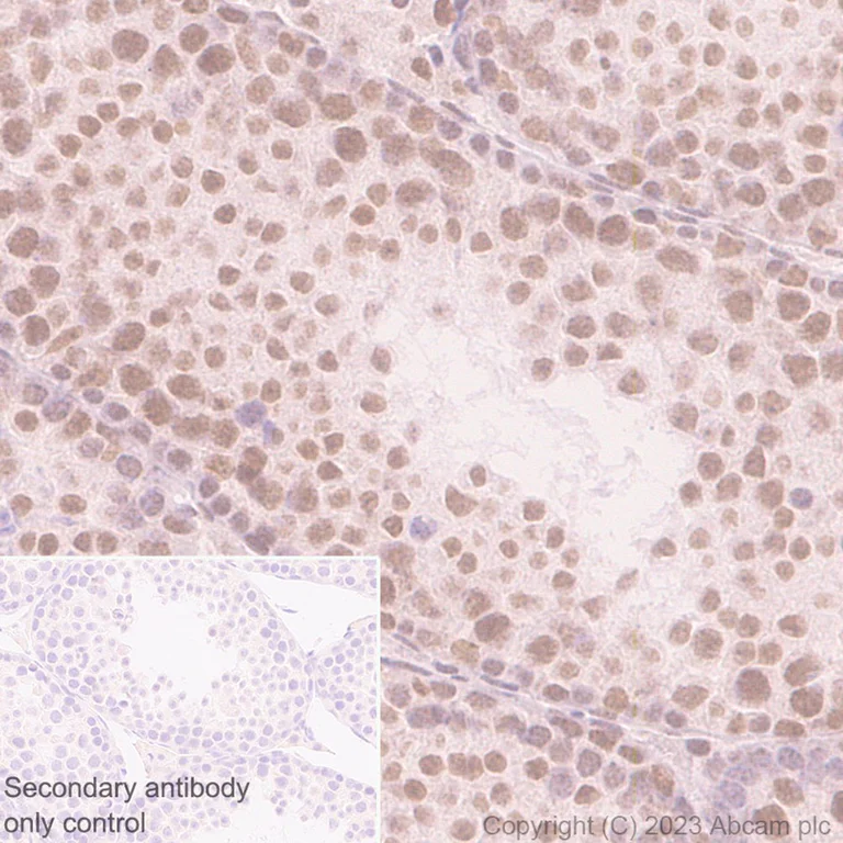 Immunohistochemistry (Formalin/PFA-fixed paraffin-embedded sections) - Anti-hnRNP C1/C2 antibody [EP3034Y] - BSA and Azide free (AB284719)