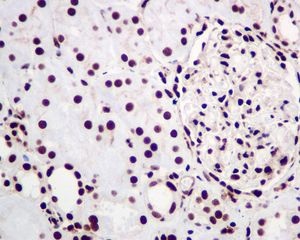 Immunohistochemistry (Formalin/PFA-fixed paraffin-embedded sections) - Anti-hnRNP C1/C2 antibody [EPNCIR152] - BSA and Azide free (AB248575), expandable thumbnail