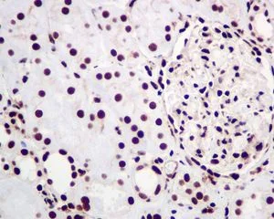 Immunohistochemistry (Formalin/PFA-fixed paraffin-embedded sections) - Anti-hnRNP C1/C2 antibody [EPNCIR152] - BSA and Azide free (AB248575)