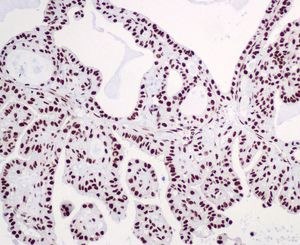 Immunohistochemistry (Formalin/PFA-fixed paraffin-embedded sections) - Anti-hnRNP C1/C2 antibody [EPNCIR152] - BSA and Azide free (AB248575), expandable thumbnail