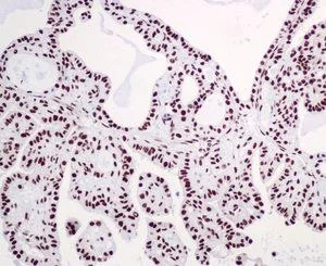 Immunohistochemistry (Formalin/PFA-fixed paraffin-embedded sections) - Anti-hnRNP C1/C2 antibody [EPNCIR152] - BSA and Azide free (AB248575)
