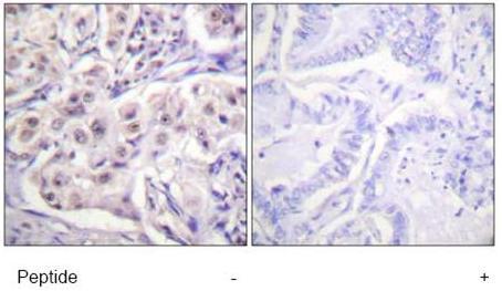 Immunohistochemistry (Formalin/PFA-fixed paraffin-embedded sections) - Anti-hnRNP D/AUF1 antibody (AB61193), expandable thumbnail