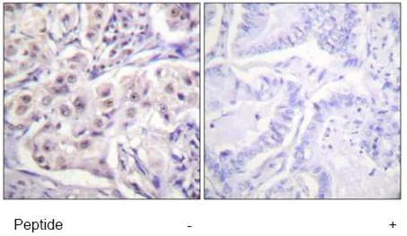 Immunohistochemistry (Formalin/PFA-fixed paraffin-embedded sections) - Anti-hnRNP D/AUF1 antibody (AB61193)