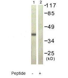 Western blot - Anti-hnRNP D/AUF1 antibody (AB61193), expandable thumbnail