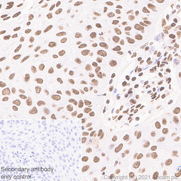 Immunohistochemistry (Formalin/PFA-fixed paraffin-embedded sections) - Anti-hnRNP D/AUF1 antibody [EPR24001-12] - BSA and Azide free (AB282018)