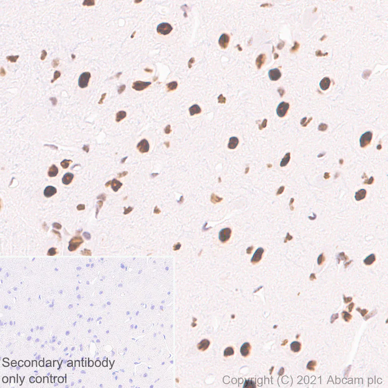 Immunohistochemistry (Formalin/PFA-fixed paraffin-embedded sections) - Anti-hnRNP D/AUF1 antibody [EPR24001-12] - BSA and Azide free (AB282018)