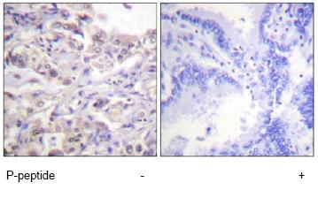 Immunohistochemistry (Formalin/PFA-fixed paraffin-embedded sections) - Anti-hnRNP D/AUF1 (phospho S83) antibody (AB61096)