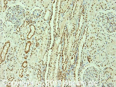Immunohistochemistry (Formalin/PFA-fixed paraffin-embedded sections) - Anti-hnRNP F+H antibody [1G11] (AB10689)