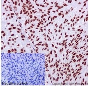 Immunohistochemistry (Formalin/PFA-fixed paraffin-embedded sections) - Anti-hnRNP G antibody [EPR16038] - BSA and Azide free (AB238987), expandable thumbnail