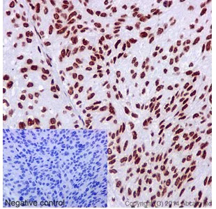 Immunohistochemistry (Formalin/PFA-fixed paraffin-embedded sections) - Anti-hnRNP G antibody [EPR16038] - BSA and Azide free (AB238987)