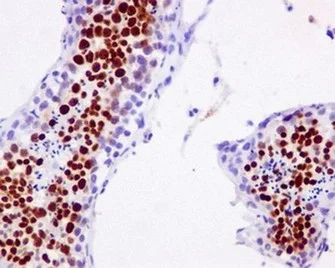 Immunohistochemistry (Formalin/PFA-fixed paraffin-embedded sections) - Anti-hnRNP G-T antibody [EPR12593-14] (AB178429)