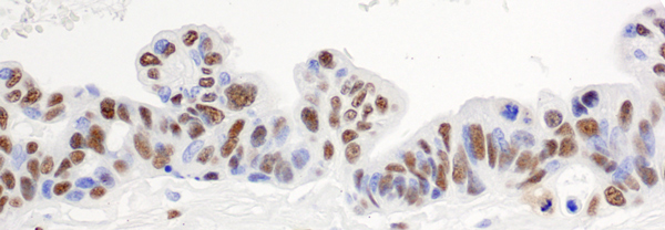 Immunohistochemistry (Formalin/PFA-fixed paraffin-embedded sections) - Anti-hnRNP H antibody (AB10374)