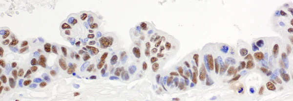 Immunohistochemistry (Formalin/PFA-fixed paraffin-embedded sections) - Anti-hnRNP H antibody (AB10374)