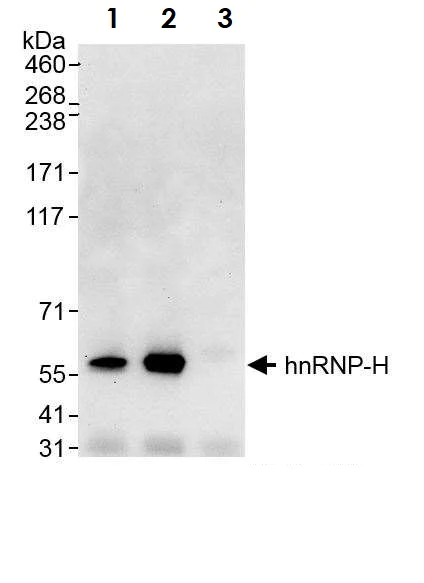 Immunoprecipitation - Anti-hnRNP H antibody (AB10374)