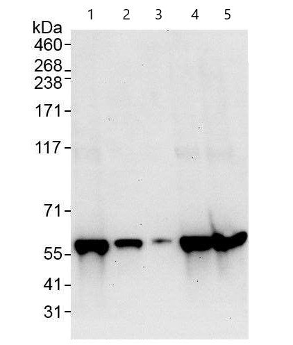 Anti-hnRNP H antibody