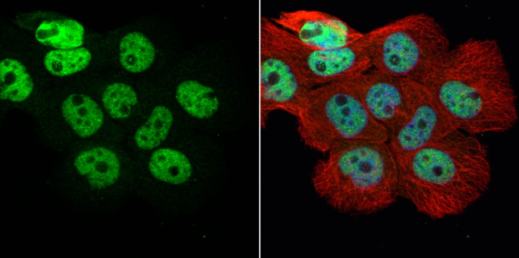 Immunocytochemistry/ Immunofluorescence - Anti-hnRNP H antibody (AB154894), expandable thumbnail