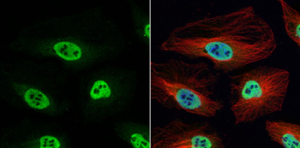 Immunocytochemistry/ Immunofluorescence - Anti-hnRNP H antibody (AB154894), expandable thumbnail