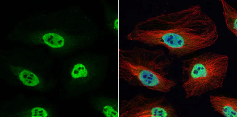 Immunocytochemistry/ Immunofluorescence - Anti-hnRNP H antibody (AB154894)