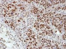 Immunohistochemistry (Formalin/PFA-fixed paraffin-embedded sections) - Anti-hnRNP H antibody (AB154894), expandable thumbnail