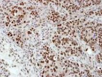 Immunohistochemistry (Formalin/PFA-fixed paraffin-embedded sections) - Anti-hnRNP H antibody (AB154894)
