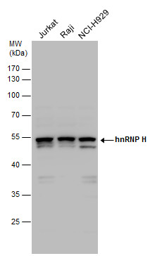 Western blot - Anti-hnRNP H antibody (AB154894), expandable thumbnail