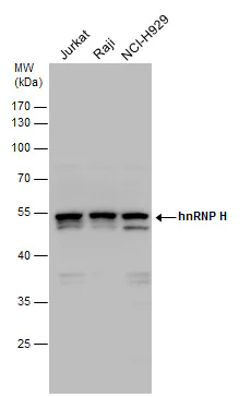 Western blot - Anti-hnRNP H antibody (AB154894)