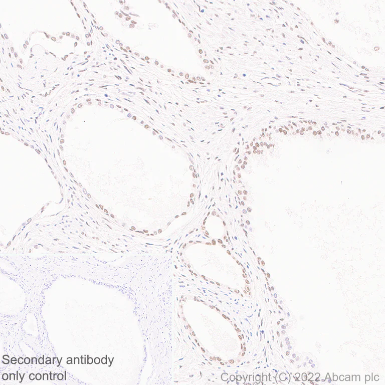 Immunohistochemistry (Formalin/PFA-fixed paraffin-embedded sections) - Anti-hnRNP H antibody [EPR25302-12] (AB289974)