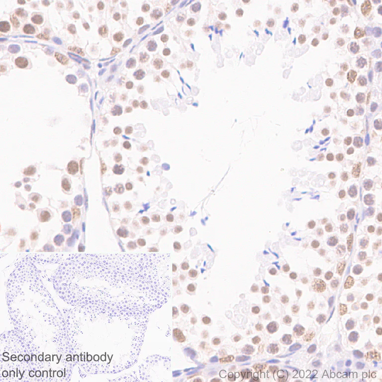Immunohistochemistry (Formalin/PFA-fixed paraffin-embedded sections) - Anti-hnRNP H antibody [EPR25302-12] (AB289974)