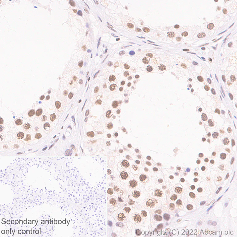 Immunohistochemistry (Formalin/PFA-fixed paraffin-embedded sections) - Anti-hnRNP H antibody [EPR25302-12] (AB289974)