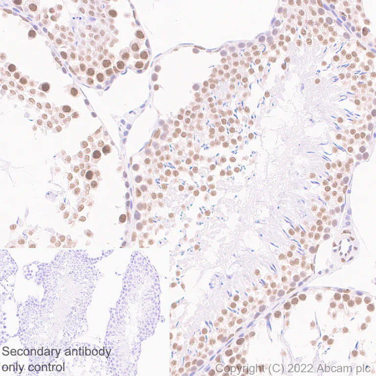 Immunohistochemistry (Formalin/PFA-fixed paraffin-embedded sections) - Anti-hnRNP H antibody [EPR25302-12] (AB289974)