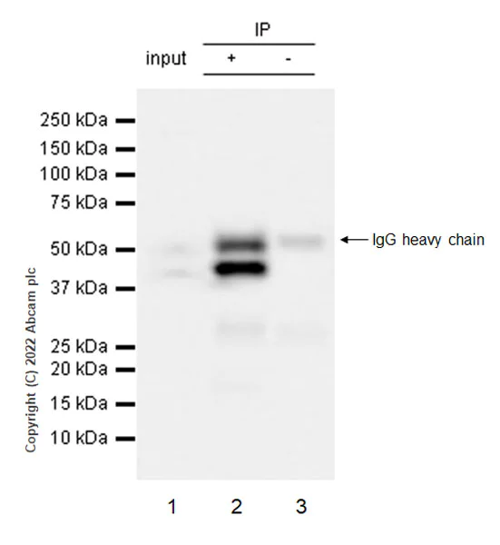 Immunoprecipitation - Anti-hnRNP H antibody [EPR25302-12] (AB289974)