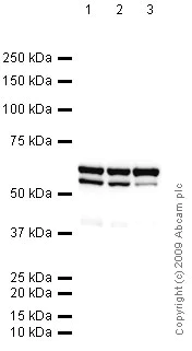 Western blot - Anti-hnRNP K antibody [3C2] (AB39975)