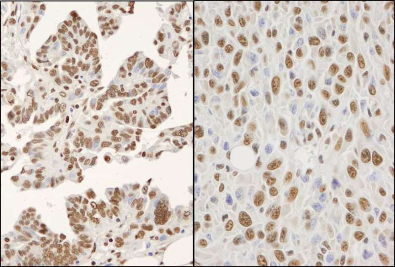 Immunohistochemistry (Formalin/PFA-fixed paraffin-embedded sections) - Anti-hnRNP K antibody (AB264138), expandable thumbnail