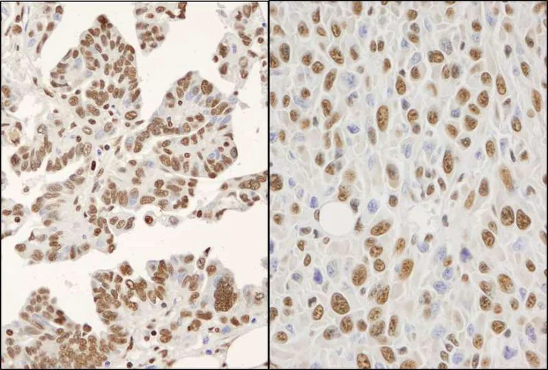 Immunohistochemistry (Formalin/PFA-fixed paraffin-embedded sections) - Anti-hnRNP K antibody (AB264138)