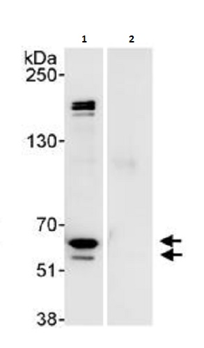 Immunoprecipitation - Anti-hnRNP K antibody (AB264138), expandable thumbnail