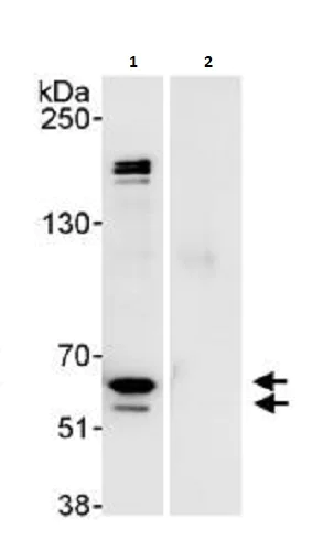 Immunoprecipitation - Anti-hnRNP K antibody (AB264138)