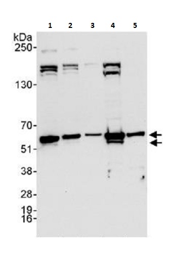 Western blot - Anti-hnRNP K antibody (AB264138), expandable thumbnail