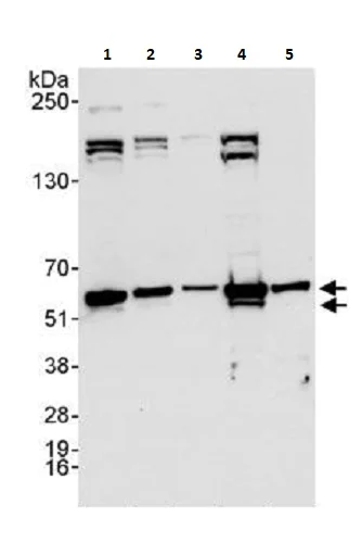 Western blot - Anti-hnRNP K antibody (AB264138)