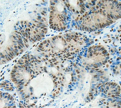 Immunohistochemistry (Formalin/PFA-fixed paraffin-embedded sections) - Anti-hnRNP K antibody (AB70492)