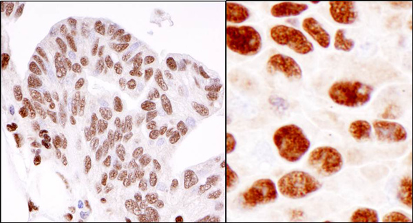 Immunohistochemistry (Formalin/PFA-fixed paraffin-embedded sections) - Anti-hnRNP K antibody (AB70492)