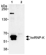 Immunoprecipitation - Anti-hnRNP K antibody (AB70492)