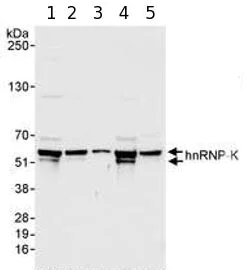 Western blot - Anti-hnRNP K antibody (AB70492)