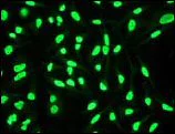 Immunocytochemistry/ Immunofluorescence - Anti-hnRNP K antibody [EP943Y] (AB52600)