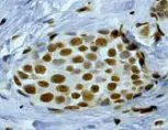 Immunohistochemistry (Formalin/PFA-fixed paraffin-embedded sections) - Anti-hnRNP K antibody [EP943Y] (AB52600)