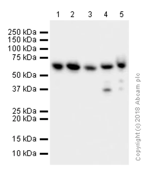 Western blot - Anti-hnRNP K antibody [EP943Y] (AB52600)