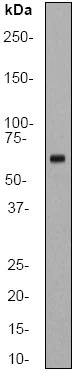 Western blot - Anti-hnRNP K antibody [EP943Y] (AB52600)