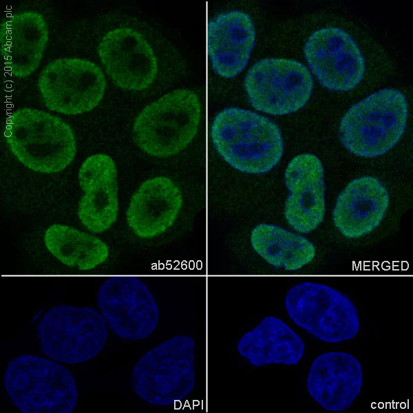 Immunocytochemistry/ Immunofluorescence - Anti-hnRNP K antibody [EP943Y] - BSA and Azide free (AB220996)