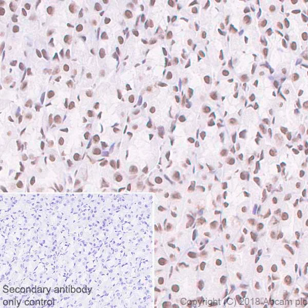 Immunohistochemistry (Formalin/PFA-fixed paraffin-embedded sections) - Anti-hnRNP K antibody [EP943Y] - BSA and Azide free (AB220996)