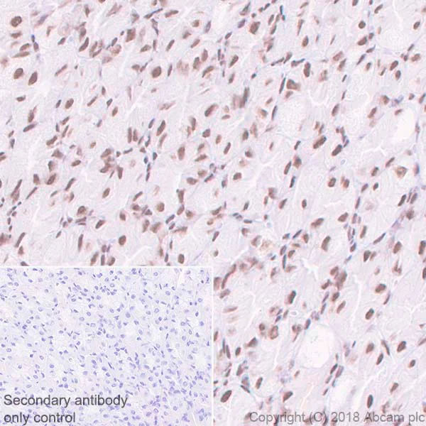 Immunohistochemistry (Formalin/PFA-fixed paraffin-embedded sections) - Anti-hnRNP K antibody [EP943Y] - BSA and Azide free (AB220996)