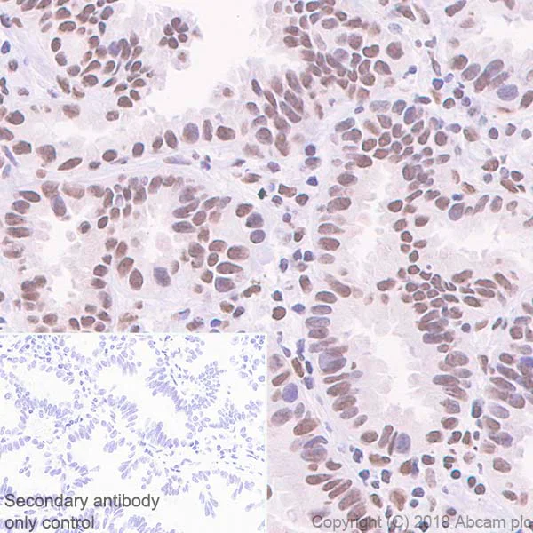 Immunohistochemistry (Formalin/PFA-fixed paraffin-embedded sections) - Anti-hnRNP K antibody [EP943Y] - BSA and Azide free (AB220996)